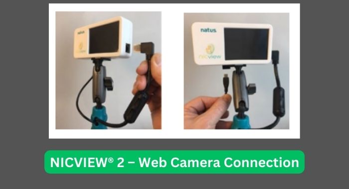NICVIEW® 2 – Web Camera Cost